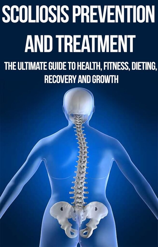 Scoliosis Prevention and Treatment: The Ultimate Guide to Health, Fitness, Dieting, Recovery and Growth: osteopathy, alternative medicine, yoga, contemporary ... Back Pain, Pain Relief, Pain Management,)      Kindle Edition